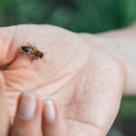 Steps to Take After a Bee Sting
